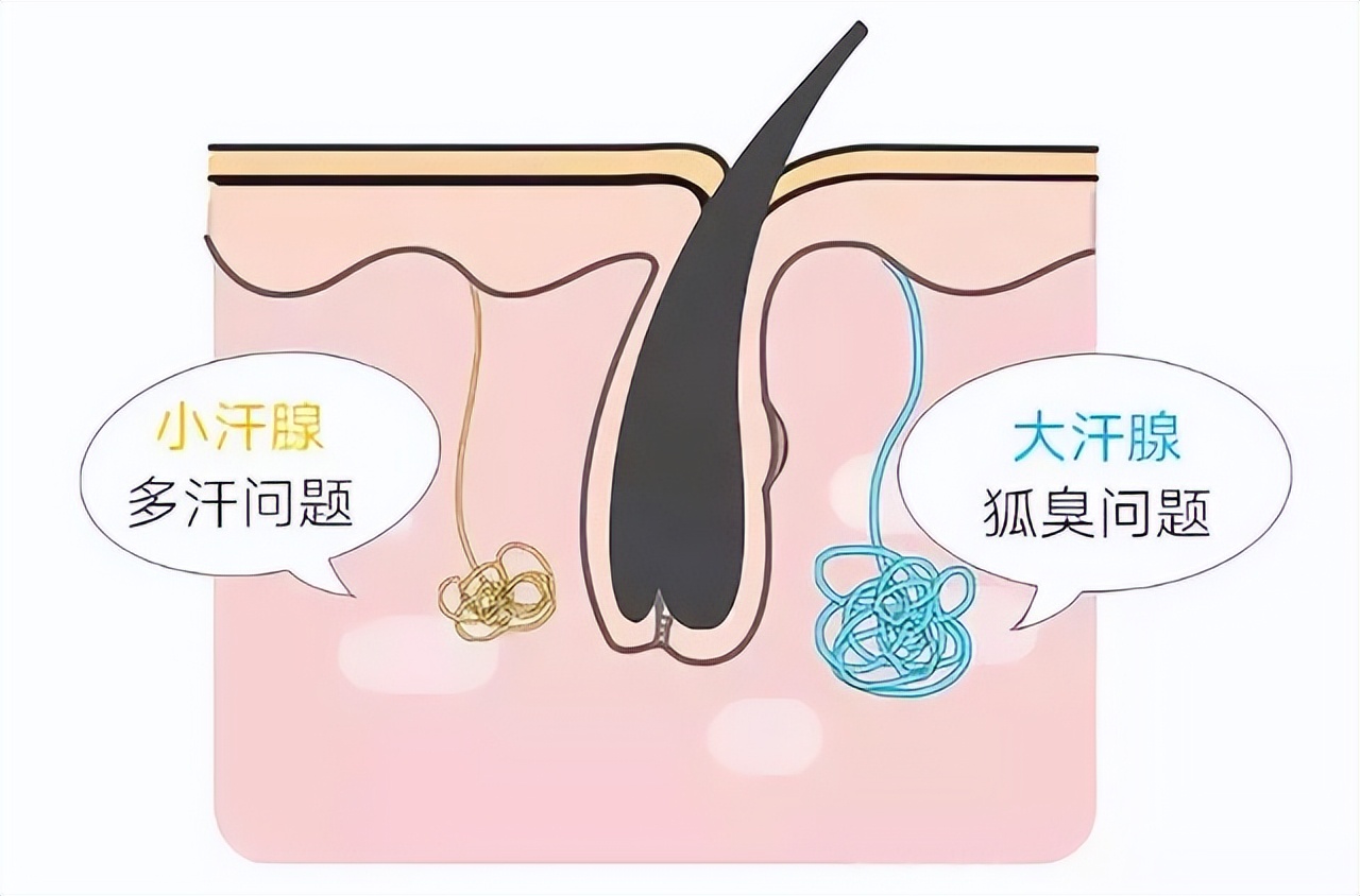 姨妈期狐臭加重怎么办,经期有狐臭味是怎么调理