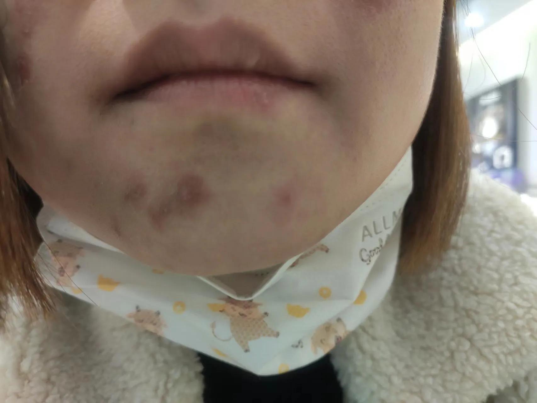 消费维权的真实案例,消费维权实用攻略