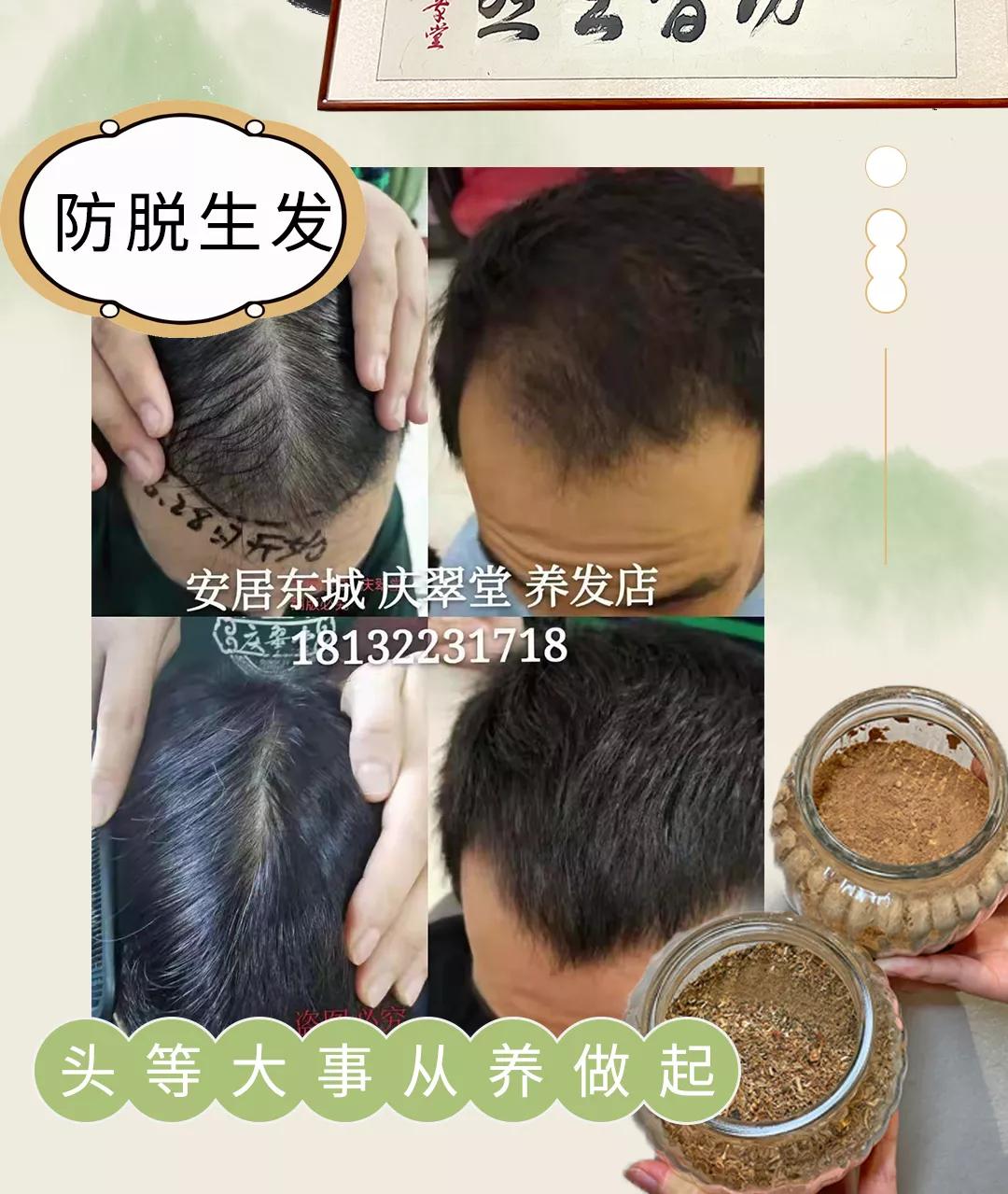 诚招养生美容产品技术合作,养发师植物养发馆加盟总部