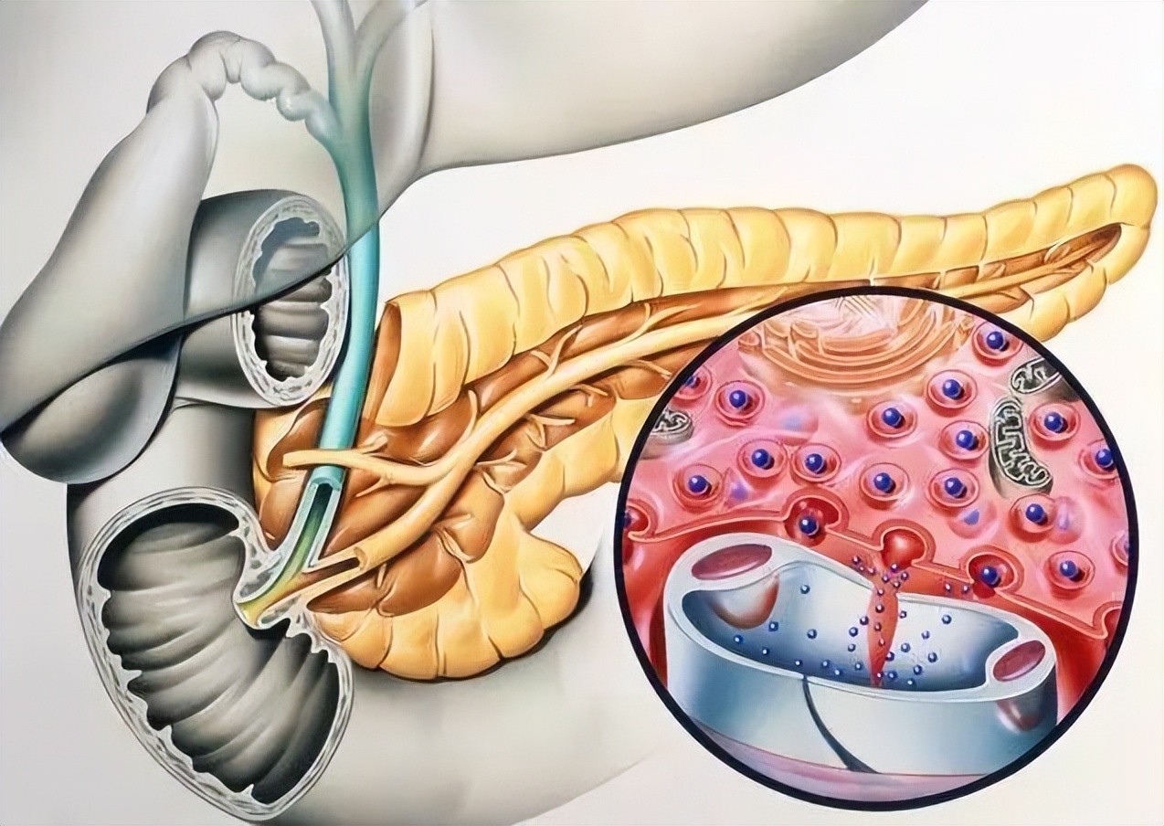 炎症会发展成癌吗,炎症发展到癌的过程