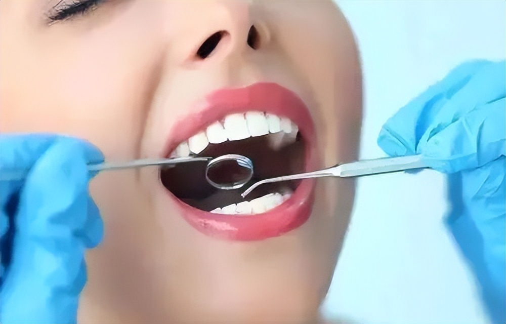 钀ヤ笟棰濊繃浜跨殑鍙ｈ厰,鍙ｈ厰閲戝瓧鎷涚墝