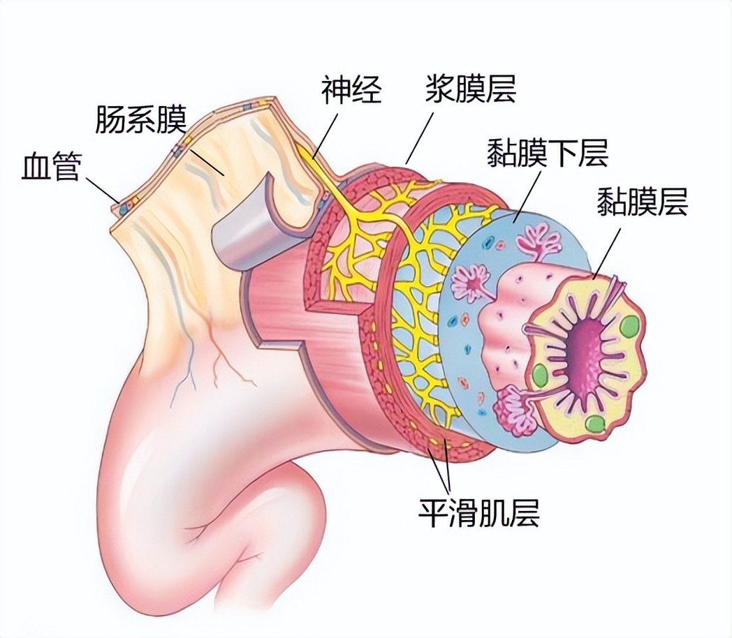 胃肠间质瘤属于肠癌吗,胃肠间质瘤会遗传吗