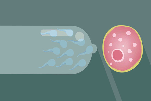 避孕套40元的与20元的区别,同样的钱买一套还是两套划算