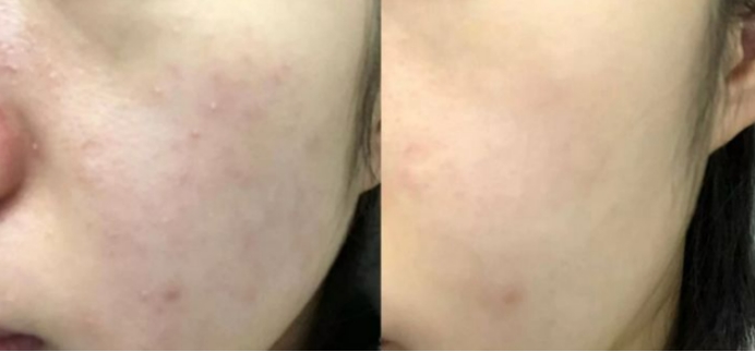 孕妇专用水乳套装排行榜前十名,孕妇水乳套装推荐第一名