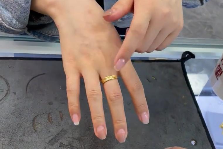 金戒指戴着皮肤过敏是怎么回事,女子戴70克金镯贴膜过敏