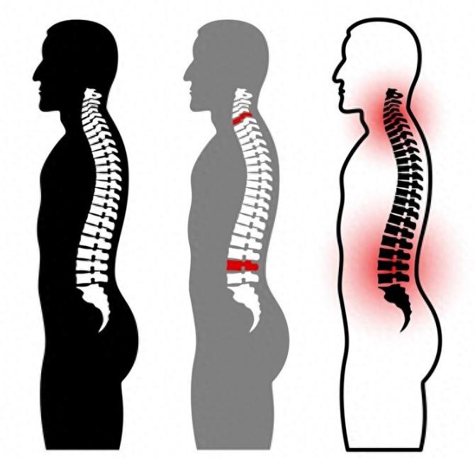 退休大爷夜间睡觉腿抽筋,猛吃钙片,却得知抽筋或是因为3个原因