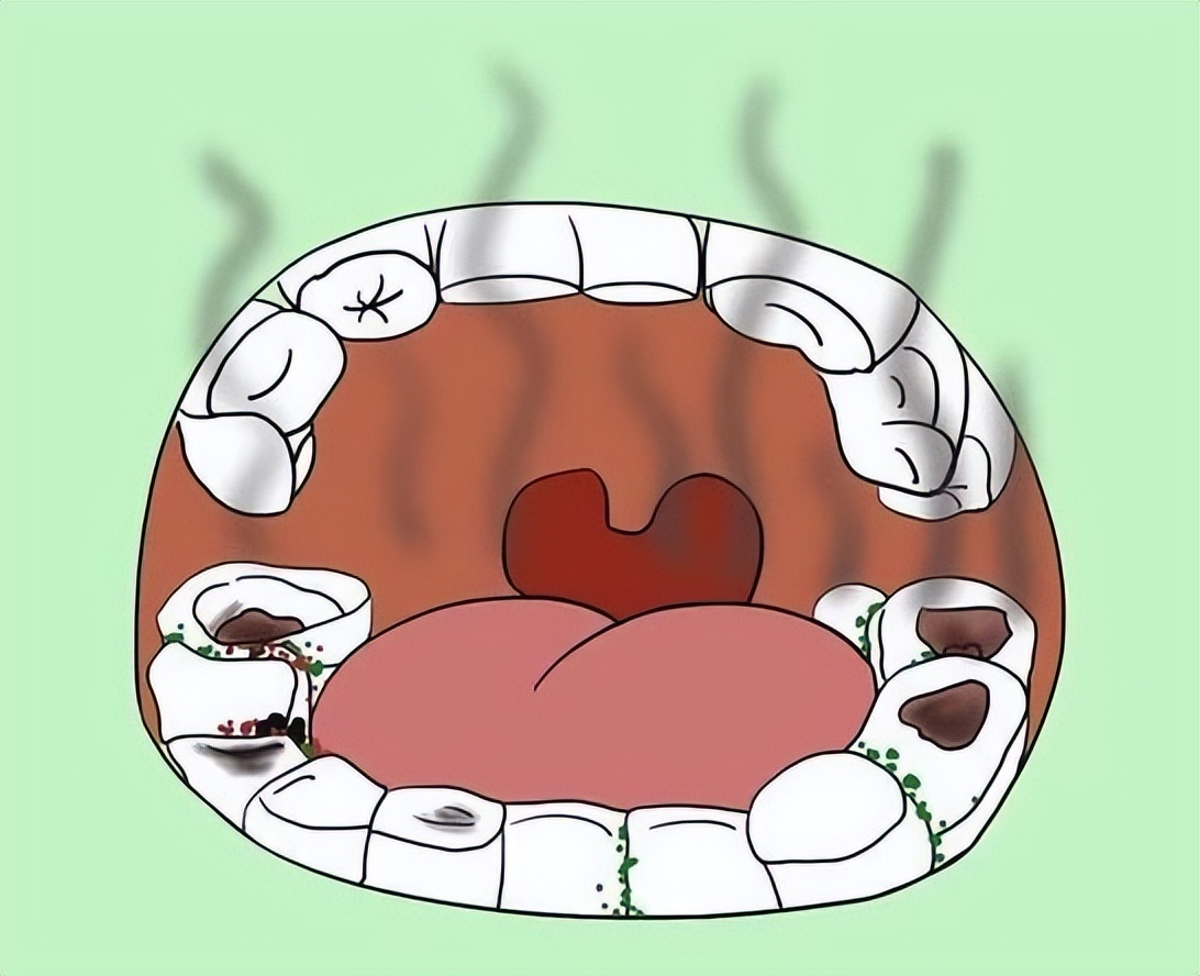 嘴里有酸臭味怎么解决,嘴里有酸甜苦咸味是怎么回事