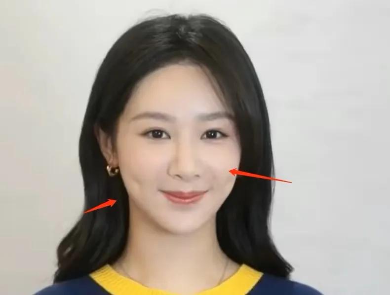 杨紫脸部最近是不是又整了,杨紫脸怎么样了