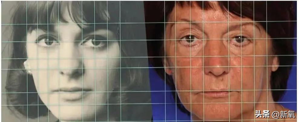 嘴唇薄变丰满,嘴唇变凸变丑怎么办