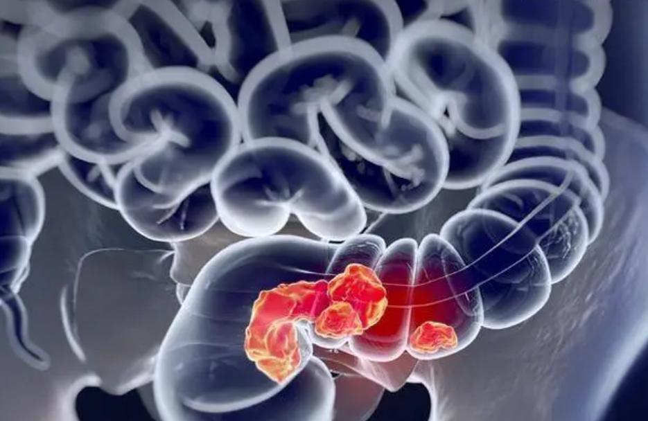 男医生给女朋友做肠镜,有男医生给女性做肠镜吗