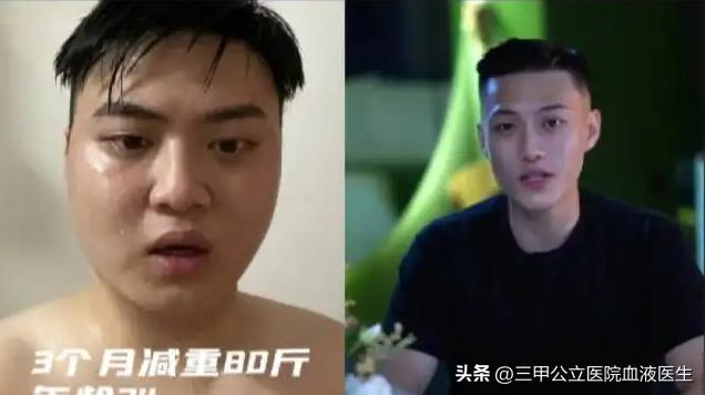 “分手成了减肥特效药”男子分手后为什么能够3个月减肥将近百斤