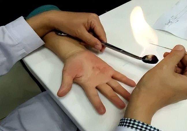 速看，你痛风有救了