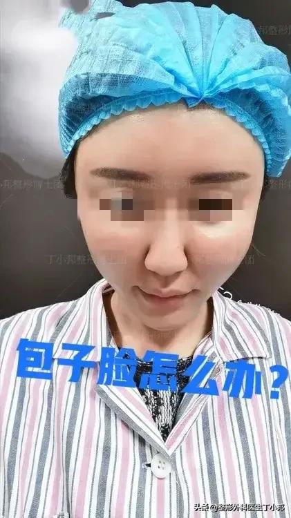 一个小姑娘毁容,一个女的毁容后才知道是救了自己