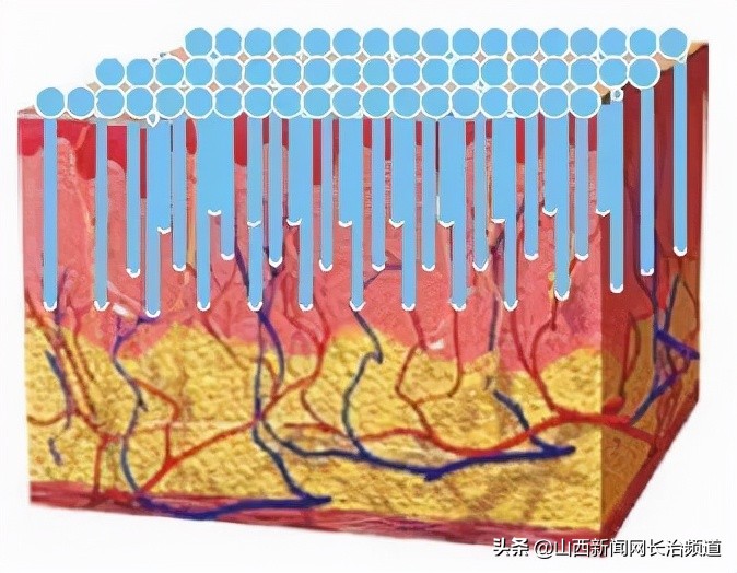 长治第二医院医疗美容科毛孔粗大,长治市第二人民医院治疗痘坑