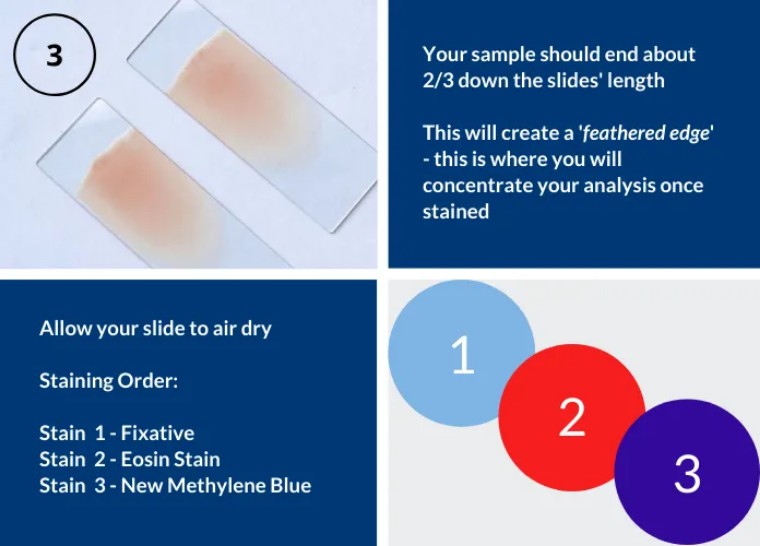 细胞涂片染色方法,涂片与染色操作
