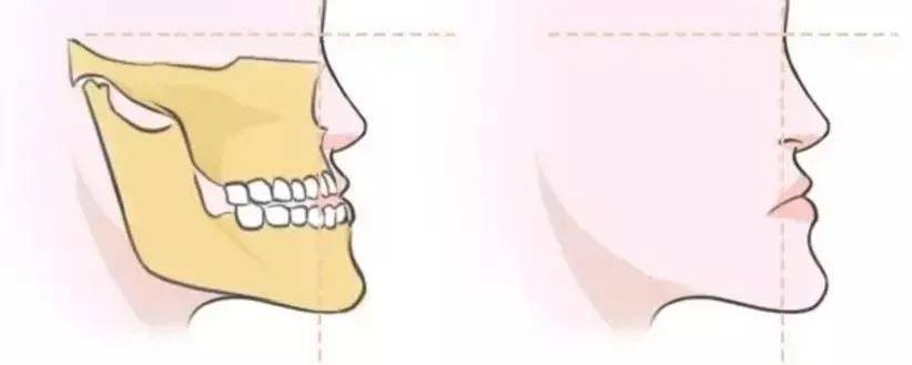 国民初恋毁容了,国民初恋盛世美颜