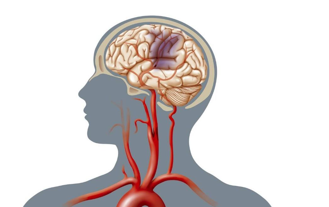 阿司匹林吃时间长了会鼻子出血吗,阿司匹林吃久了血管会变脆