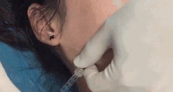 45岁脸垮有什么办法,四十岁怎样防止脸部发腮