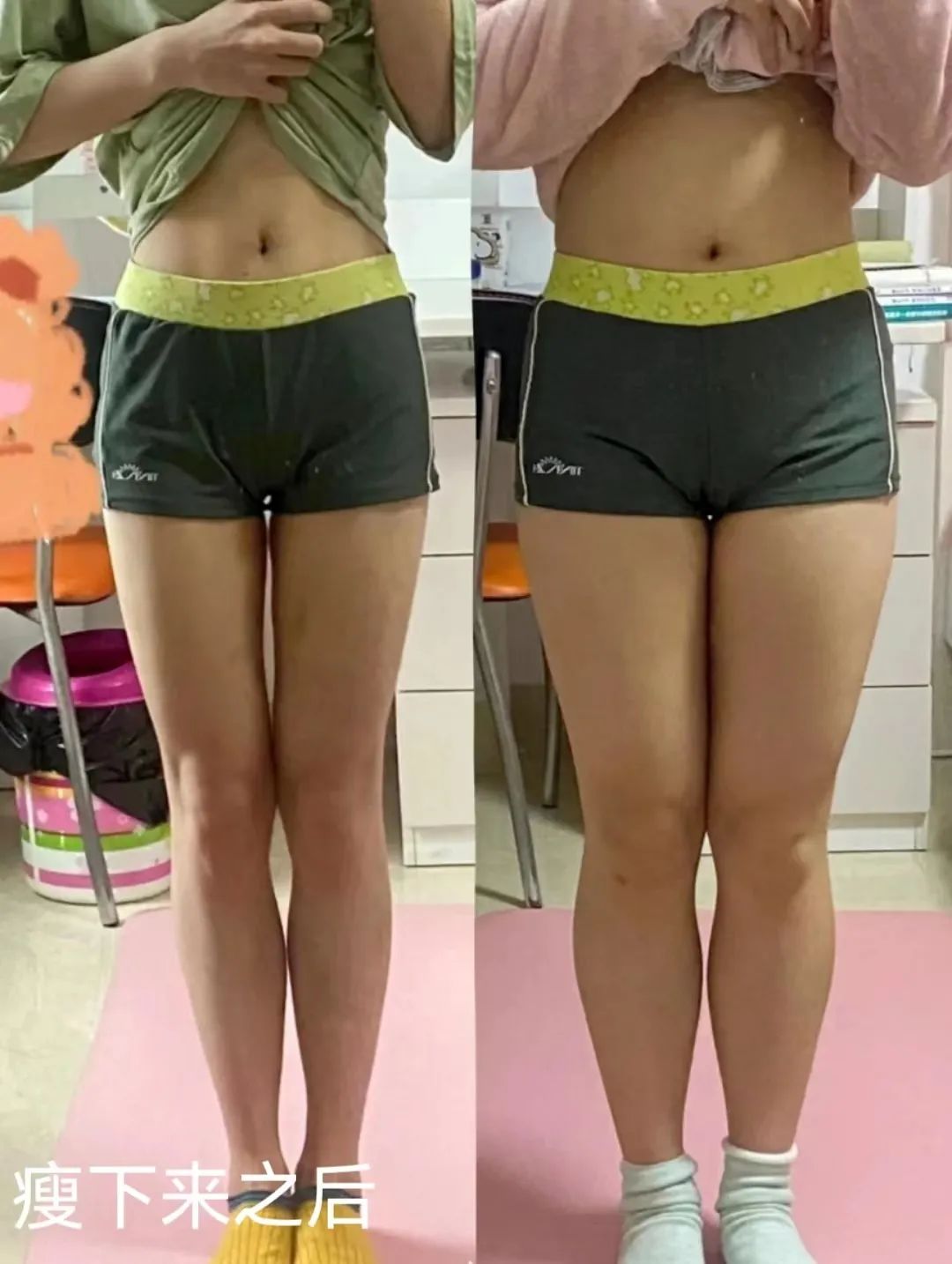 为什么男生的腿都要比女生细,为什么男生都喜欢腿细的女生