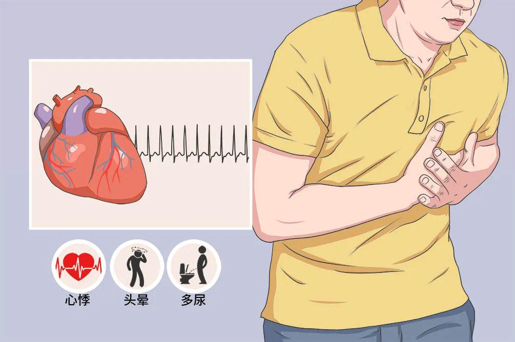 窦性心动过速一般是什么引起的,窦性心动过速应该注意什么