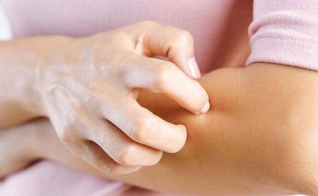 阴虱是什么？为什么有人“莫名其妙”染上了？原来有2个传播途径