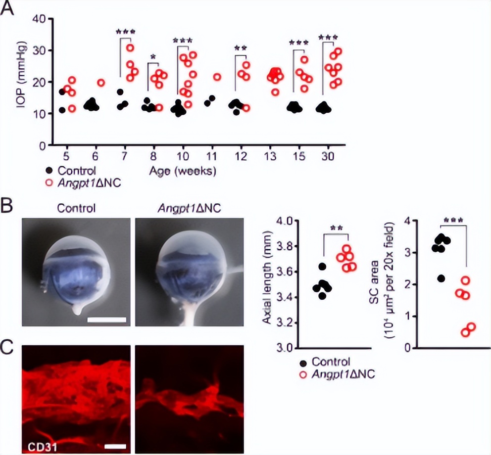 青光眼逆转,治疗青光眼临床新突破