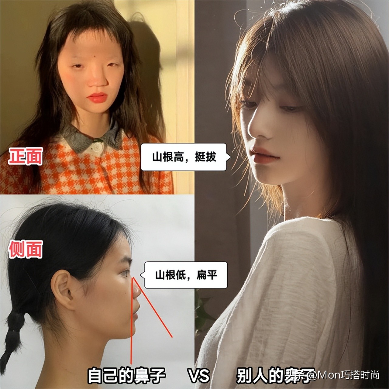 鼻子显凶显老怎么办,鼻子塌陷是不是显得人难看