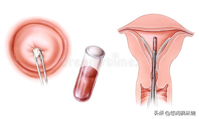 孕期各种困扰专家帮你解决,孕期常见问题及处理小结