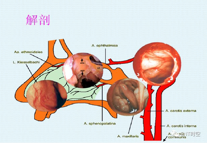 引起鼻出血的病因有哪些,鼻出血病因及诊断治疗方法推荐