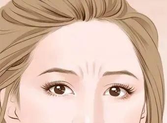 川字纹去皱纹最快的方法,除川字纹皱纹的最好方法