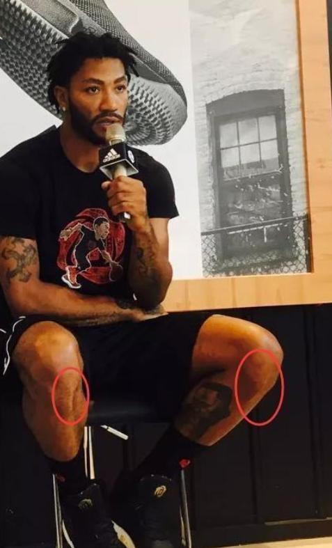 看到这些照片，就不羡慕NBA球星的高薪了！詹姆斯脚趾科比脚后跟