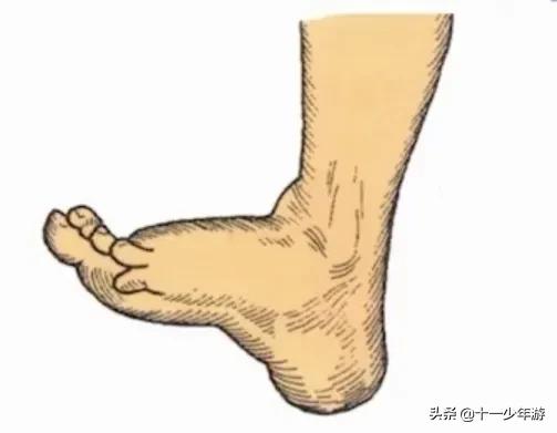 周围神经病和外周神经病,周围神经病