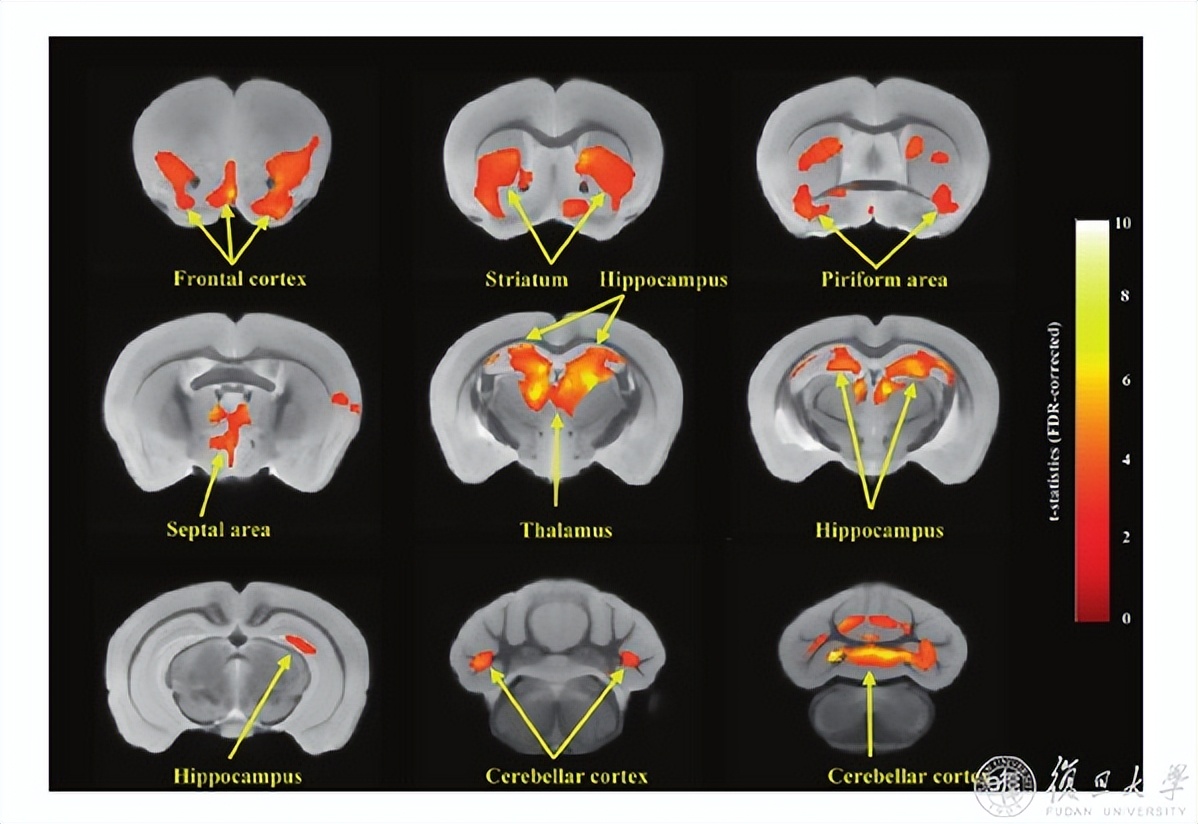 复旦团队发表研究成果,复旦大学最新科研消息
