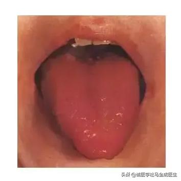 一补就上火的人怎么调理,舌苔上火怎么调理