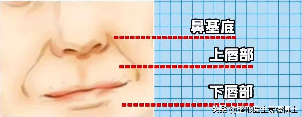 法令纹重就丑吗,法令纹丑了怎么办