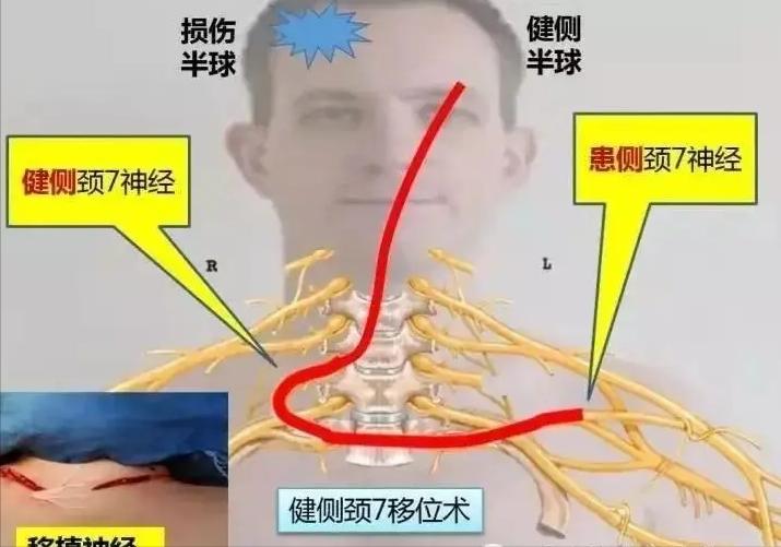 手是第二个大脑,如何理解手是人的第二大脑