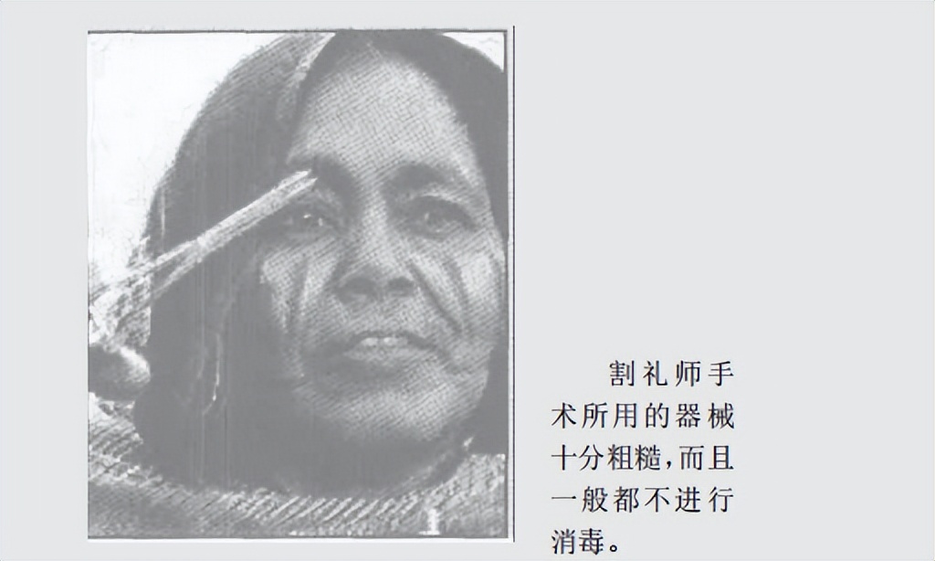 1.3亿人遭受的割礼之痛,为何现在还在继续?究竟何时才能消失?