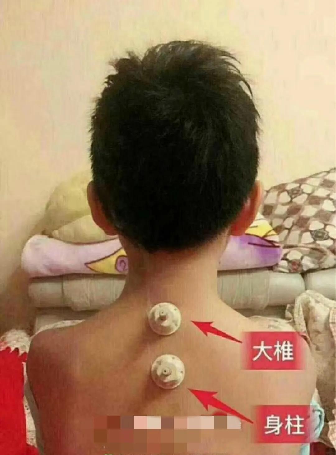 3-18岁是孩子长高黄金期,什么时候是小孩长高的黄金期