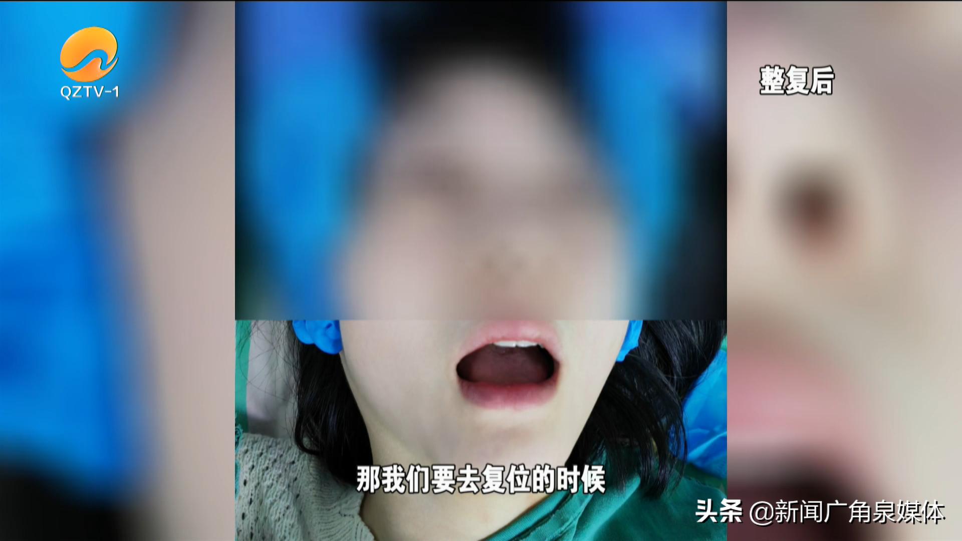 核酸采样咽拭子掉落,核酸采样口腔拭子折断位置