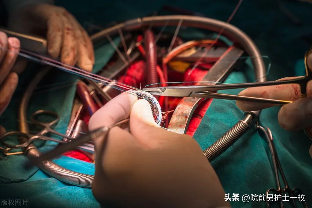 关于急诊清创缝合术必须掌握知识