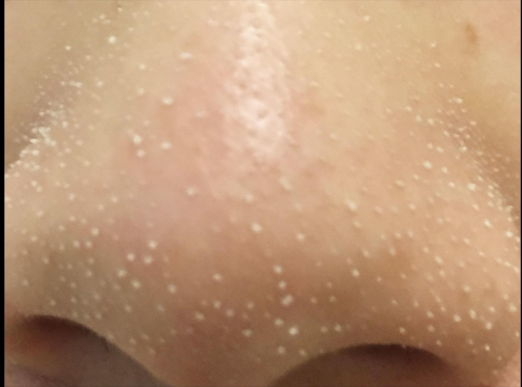 去除鼻子黑头收缩毛孔小妙招,鼻子黑头毛孔大抹什么药膏