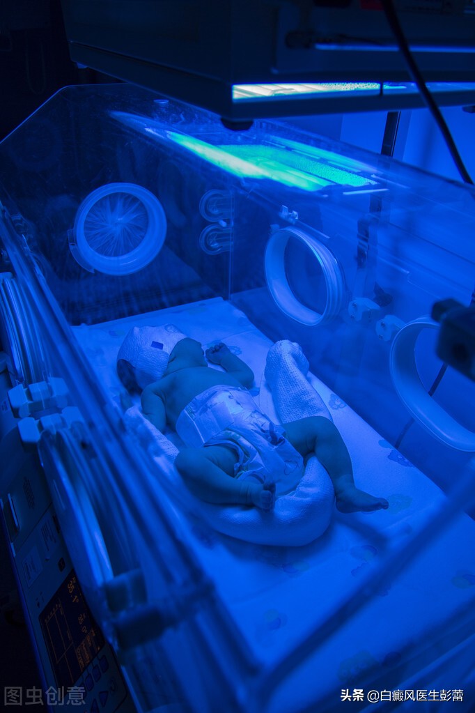 窄谱uvb有效果吗,窄谱uvb配合啥效果好