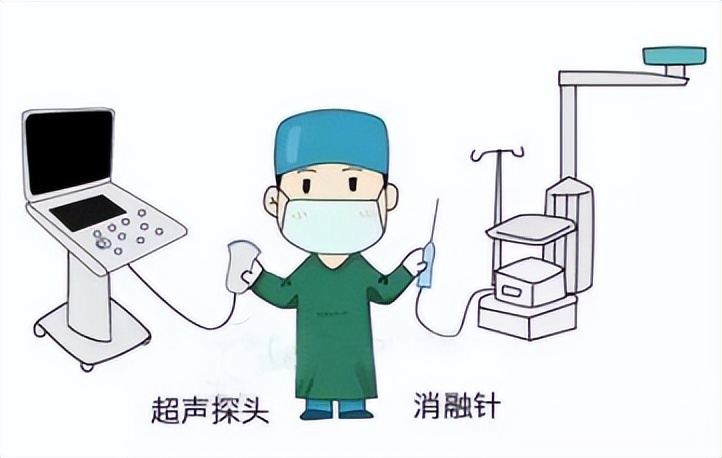 微波消融乳腺结节效果怎么样,乳腺结节不用慌