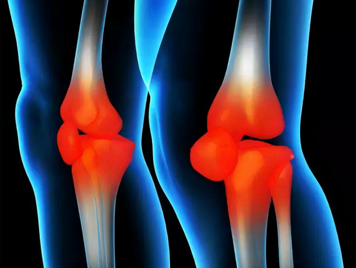 寒湿型类风湿关节炎中医治疗方法,中医看类风湿性关节炎哪家医院好