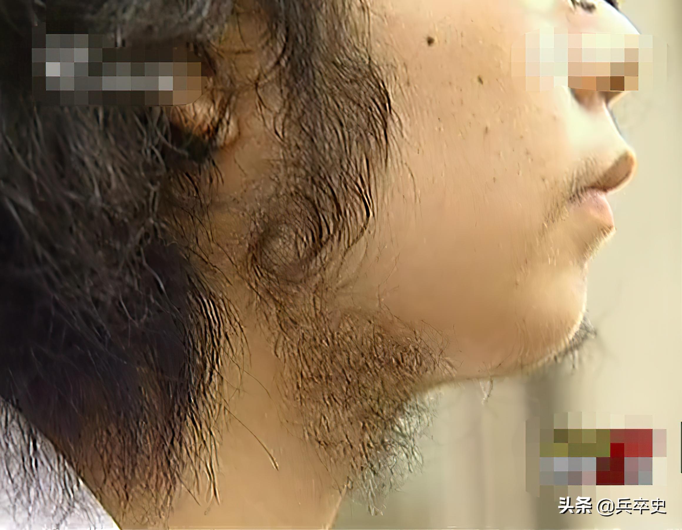 胡子女的真实故事,真实事件女孩长胡子