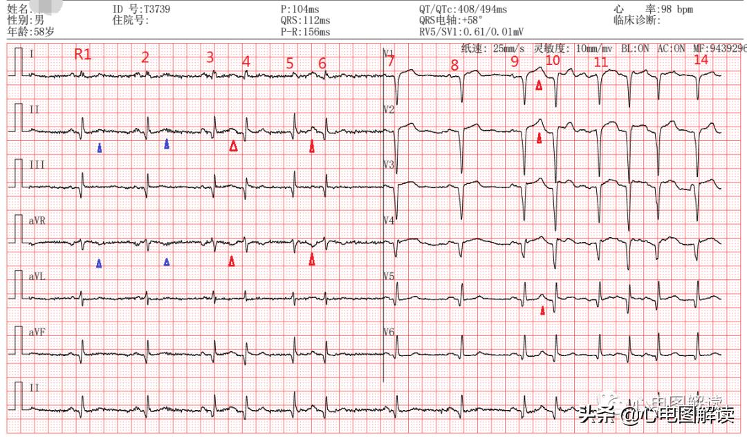 蹇冩埧棰ゅ姩鍗掍腑,鍒濆彂蹇冩埧棰ゅ姩