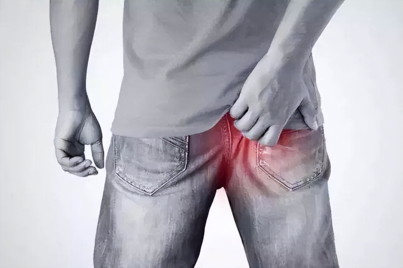 肛周癌与肛门瘙痒的区别,肛周长期瘙痒是有癌症吗