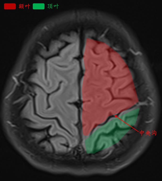 肘关节mri图谱大全,腕关节mri解剖图谱