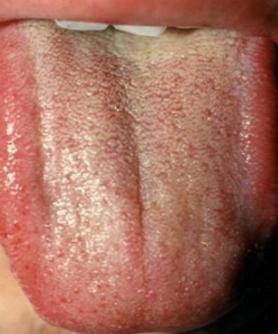 失眠4种中成药解决你的睡眠难题,失眠彻底治愈的七大方法