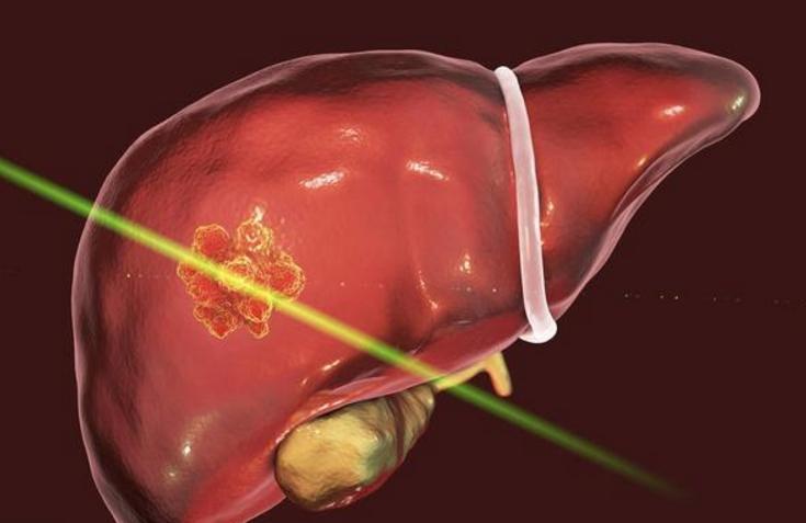 肝不好会出现一些信号,肝不好的人手上会出现哪六个暗示